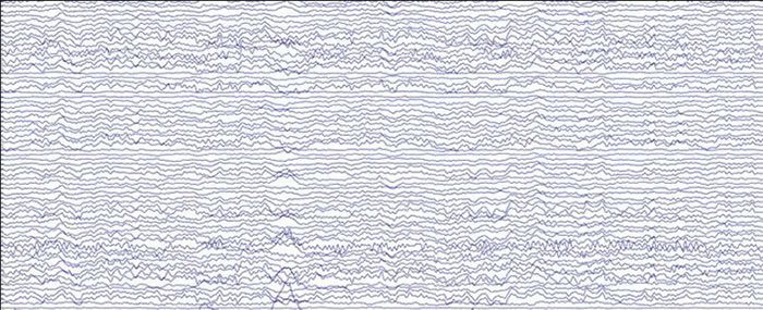 Sample EEG reading when a person's brain is in a calm state