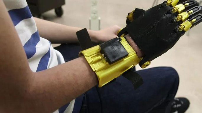 Sergio Peralta's robotic hand created by his classmates