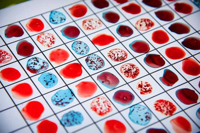 Blood Test Chart