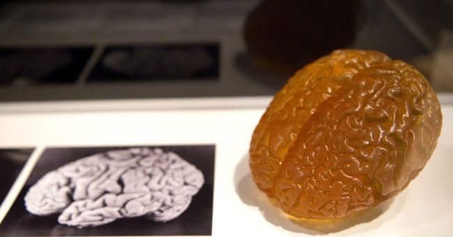 Image and model of Albert Einstein's brain