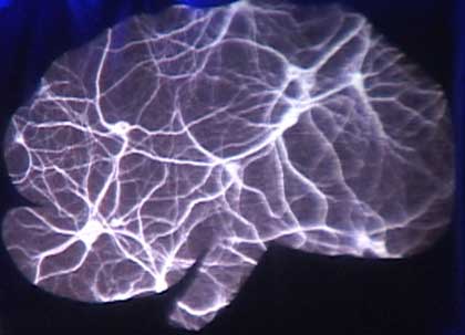 Neurons in the brain