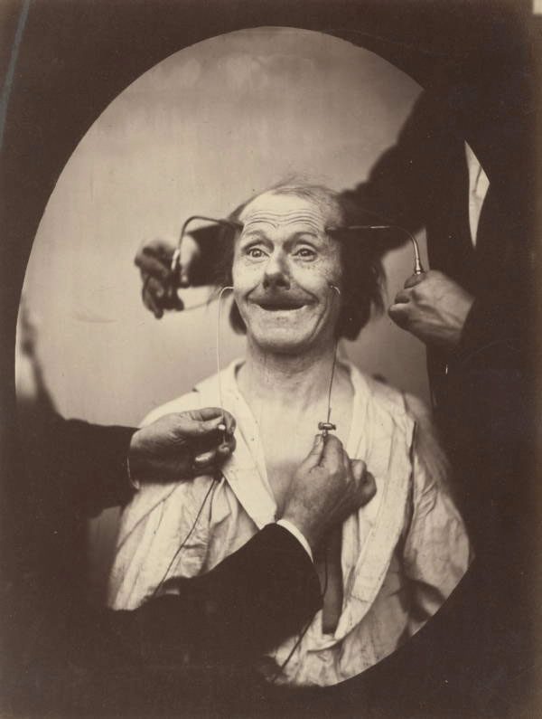 Electric Stimulus Experiment on the Face