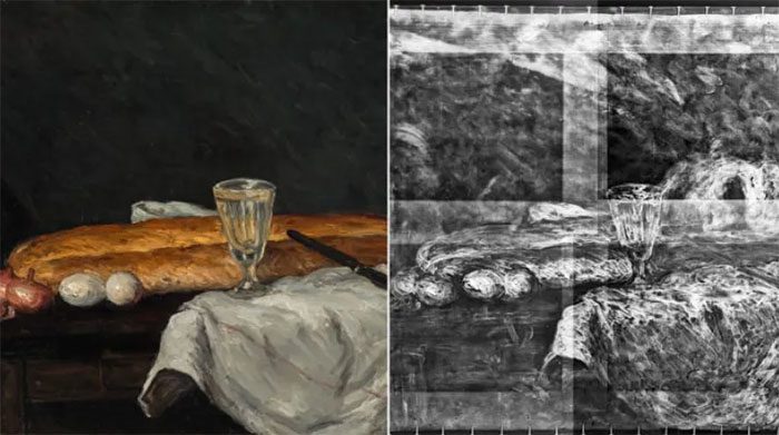 X-ray image flipped horizontally for parallel comparison.