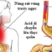 cat eating diet reducing symptoms unbearable people with acid reflux should know 126216