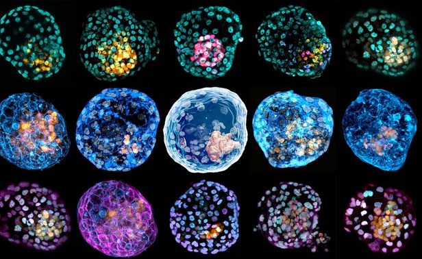 Structure of a human chimera developed by Monash University, Australia.