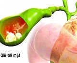 diet plan for people with eyesight issues 6511