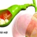 diet plan for people with eyesight issues 6511