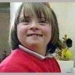 discovery of gene causing down syndrome 6795