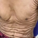 disease unique causes 27 year old young mans skin to burn 126171