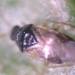 doctors use acupuncture to treat hemorrhoids 6670
