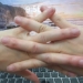 finger joint degeneration early 125163