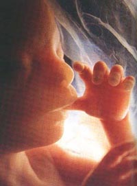 foetus3