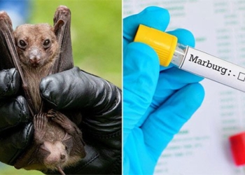health ministry strengthens monitoring of high risk marburg disease 126459
