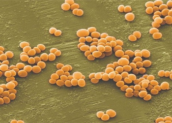 how golden rod bacteria invades dangerous foods 95499