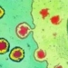 how hiv spreads in the body 7413