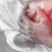 how to differentiate between stroke and hemorrhage 126262