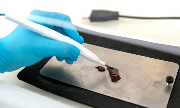 The iKnife developed by a team of researchers at the Royal College of London.