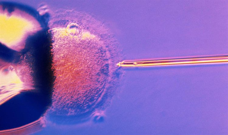 In Vitro Fertilization