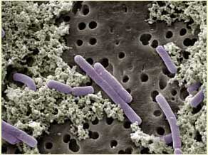 Lactobacillus casei bacteria