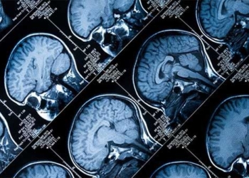 learning can be the best way to prevent cognitive decline 125781