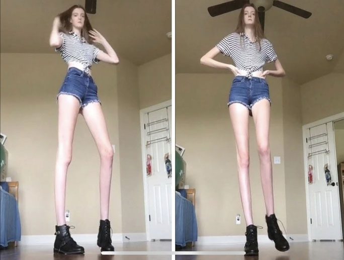 The person with the longest legs