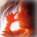 new device detects genetic defects in fetuses 6423