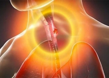 new scientific discoveries help treat pancreatic cancer 126317
