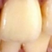new technology helps teeth grow back 6690