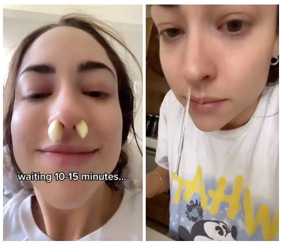 This woman inserted peeled garlic cloves into her nose and waited 10 minutes before removing them.