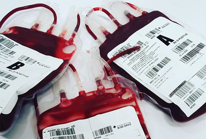 Individuals with blood type O may have fewer cardiovascular issues.