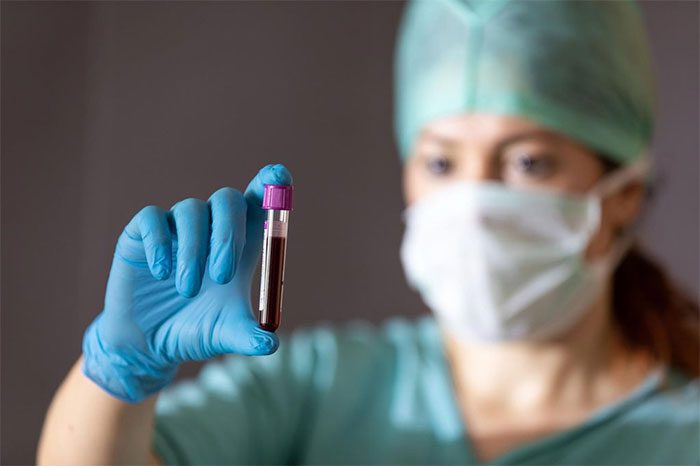 Blood type A has an 18% higher risk of early stroke compared to individuals with other blood types.