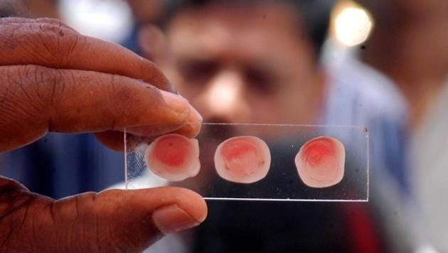 Blood type may affect cardiovascular disease risk.