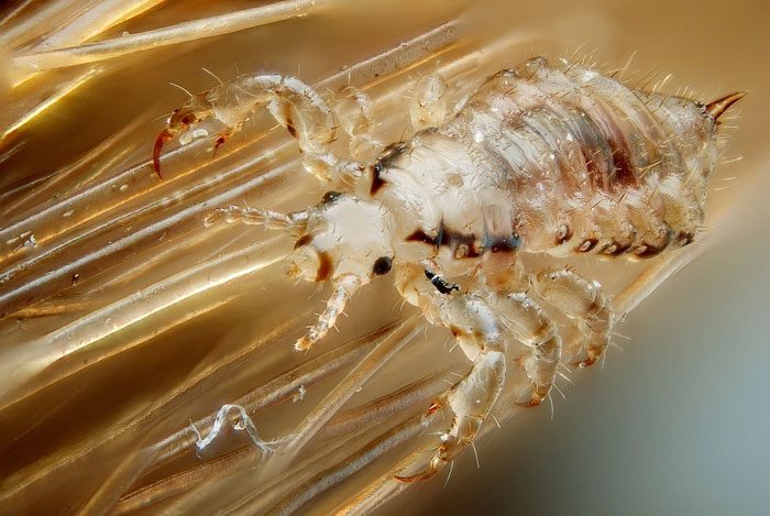 Blood-sucking lice