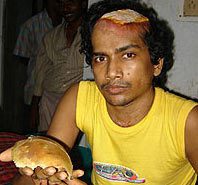 Roy holding a piece of his skull