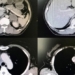 small lung cancer immunotherapy 125963