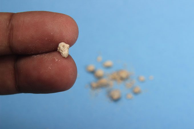 Image of a kidney stone after being expelled from the body.