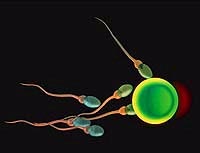 sperm
