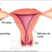spinal cord compression what is it is it dangerous 94349