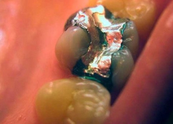 strange disease of the gums in the 19th century 126450