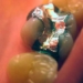 strange disease of the gums in the 19th century 126450