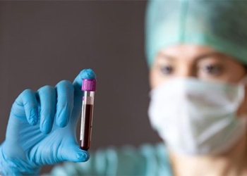 study detect blood type predict early stroke risk 125105