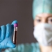 study detect blood type predict early stroke risk 125105