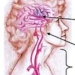 sudden blindness could be a sign of brain hemorrhage 7336