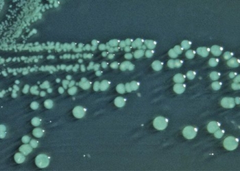 the shape of bacteria that lived 3 8 billion years ago appeared 124697