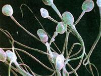 Sperm