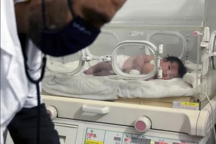An infant born under the rubble in Syria and rescued.