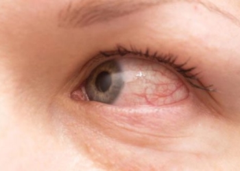 types of skin allergies and symptoms for accurate differentiation 125940