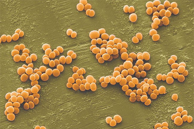 Anyone can suffer from food poisoning after consuming food contaminated with Staphylococcus aureus.