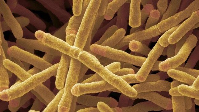 Image of a bacterium that can use hydrogen from the atmosphere to generate electricity.