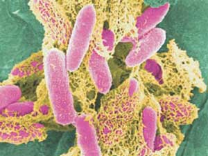 Bacteria